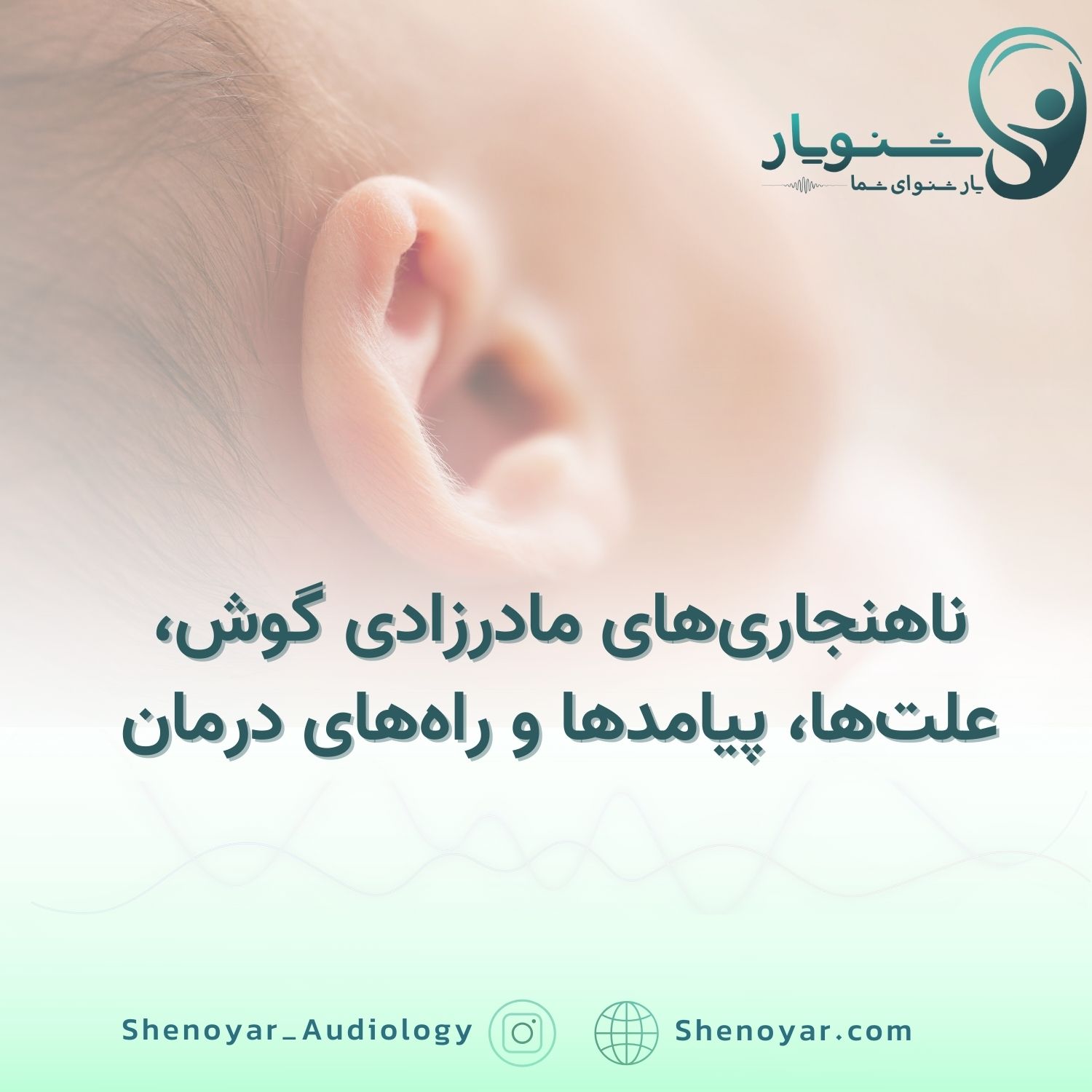 ناهنجاری‌های مادرزادی گوش، علت‌ها، پیامدها و راه‌های درمان