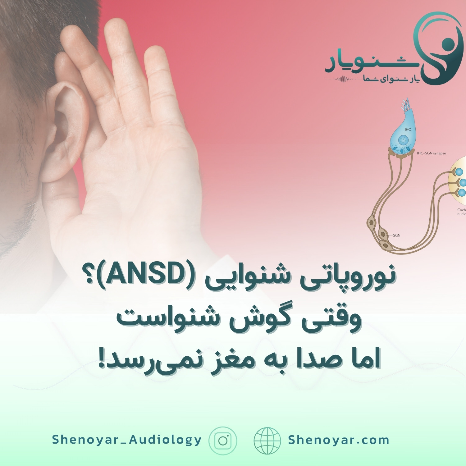 نوروپاتی شنوایی (ANSD): وقتی گوش شنواست اما صدا به مغز نمی‌رسد!